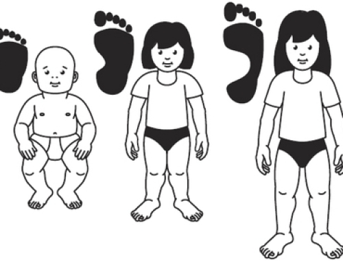 Il piede piatto pediatrico