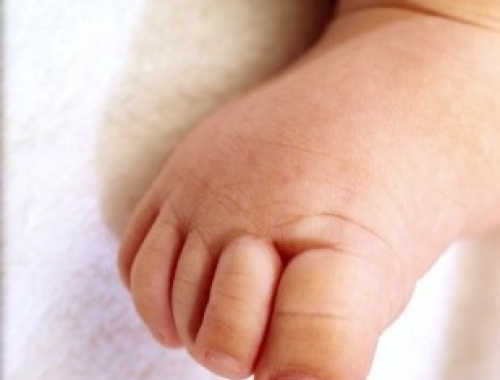 Pachionichia in età pediatrica (caso clinico)